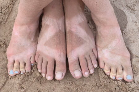 Tan lines seen on feet from river sandals.